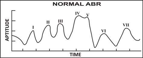 abr results|normal abr results.
